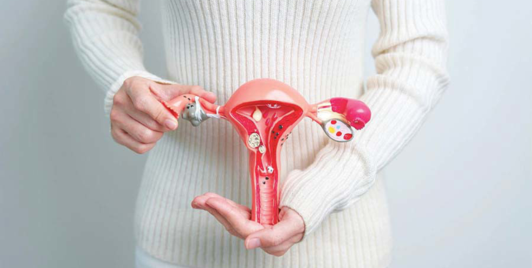 Endometriosis Treatment in Baner Pune