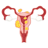 Laparoscopic & Hysteroscopic Surgeries