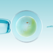 Infertility Management